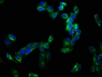 ADAM10 Antibody