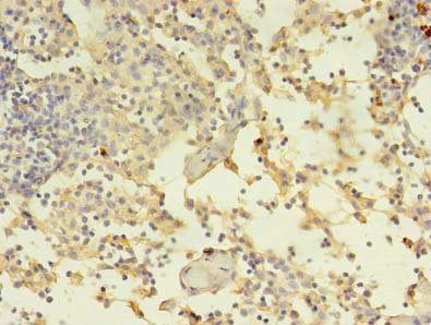 ADAM10 Antibody