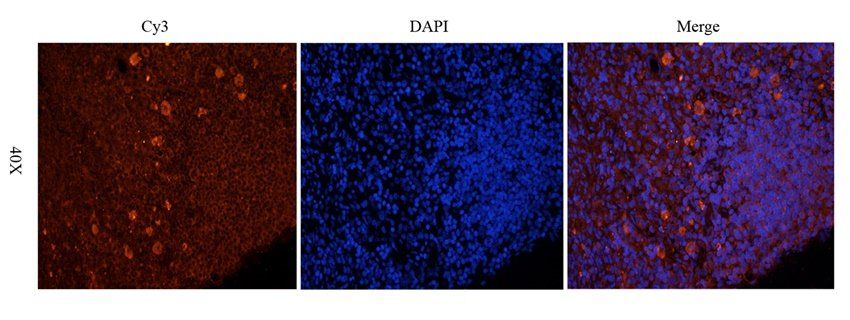 ADAM8 Rabbit Polyclonal Antibody