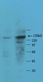 ADAMTS2 Rabbit Polyclonal Antibody