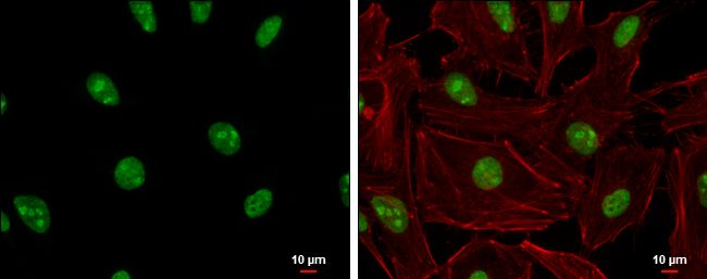 ADAR1 Rabbit Polyclonal Antibody