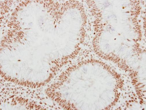 ADAR1 Rabbit Polyclonal Antibody