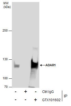 ADAR1 Rabbit Polyclonal Antibody