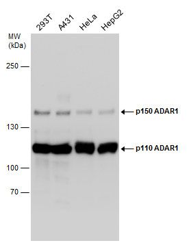 ADAR1 Rabbit Polyclonal Antibody