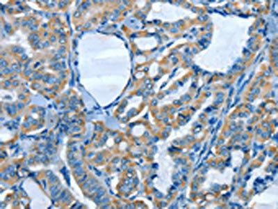 COQ8B Antibody