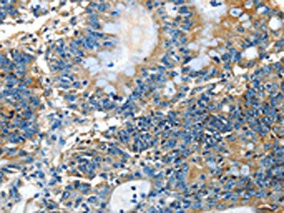 COQ8B Antibody