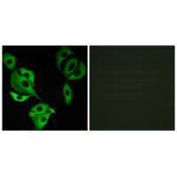 COQ8B Antibody