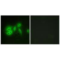 ADCY8 Antibody