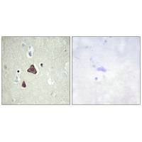 ADCY8 Antibody