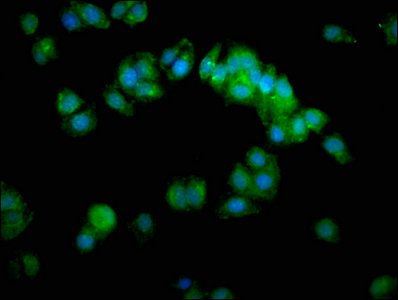 AHCY Antibody