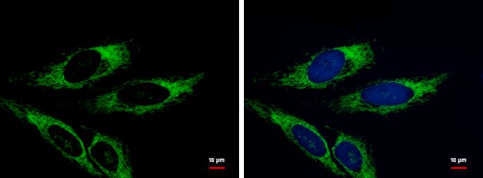 Adenylate kinase 4 Rabbit Polyclonal Antibody