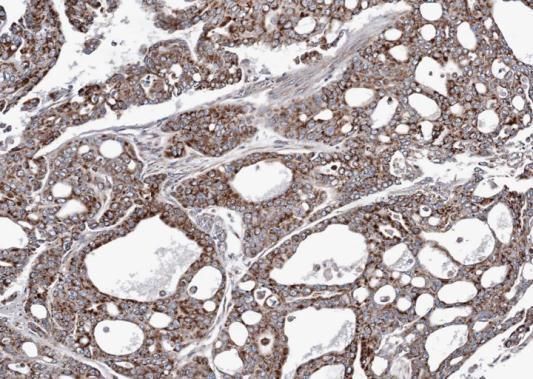Adenylate kinase 4 Rabbit Polyclonal Antibody