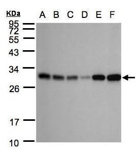 Adenylate kinase 4 Rabbit Polyclonal Antibody