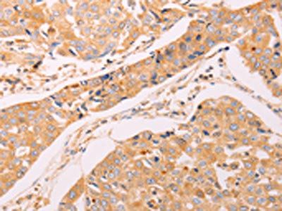ADH1B Antibody