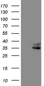 Adiponectin Antibody