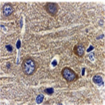Adiponectin Antibody