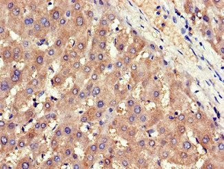 ADIPOR1 Antibody