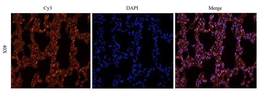 Adrenomedullin Rabbit Polyclonal Antibody