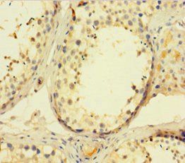 AFTPH Antibody