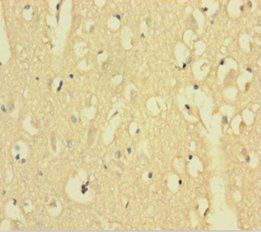 AFTPH Antibody