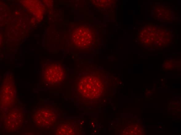 AFX (Phospho-Ser197) Antibody