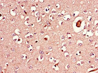 AGK Antibody