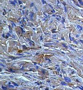 AGK Rabbit Polyclonal Antibody
