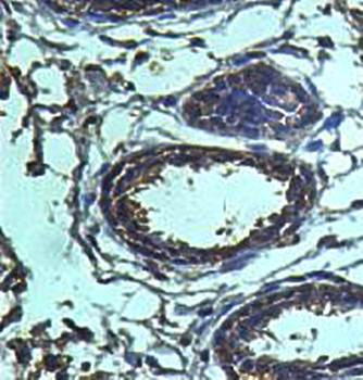 AGPAT9 Rabbit Polyclonal Antibody