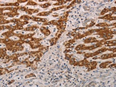 AIFM1 Antibody