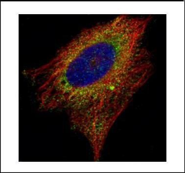 AIMP1 Rabbit Polyclonal Antibody