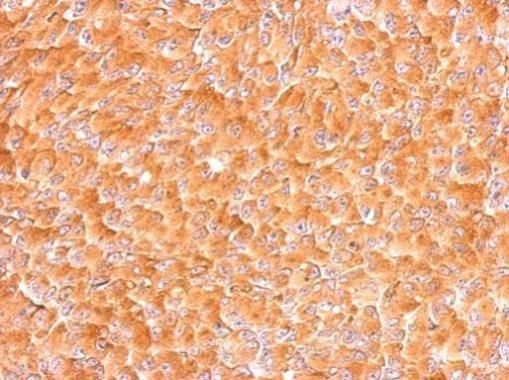 AIMP1 Rabbit Polyclonal Antibody