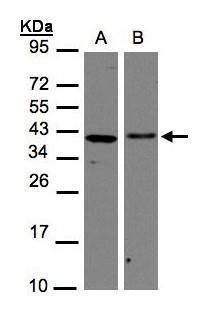AIMP1 Rabbit Polyclonal Antibody