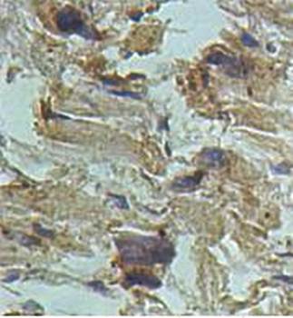 AIP Rabbit Polyclonal Antibody