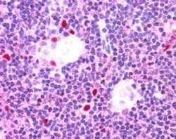 AIRE Antibody