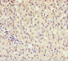 AKR7A2 Antibody