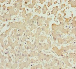AKR7A2 Antibody