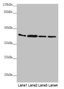 AKR7A2 Antibody
