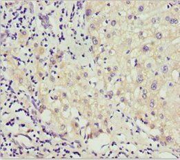AKR7A2 Antibody