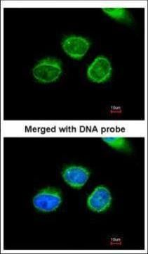 AKR7A2 Rabbit Polyclonal Antibody