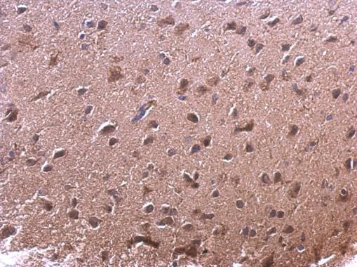 AKR7A2 Rabbit Polyclonal Antibody