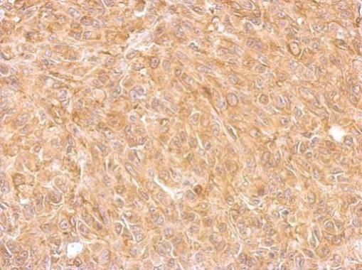 AKR7A2 Rabbit Polyclonal Antibody