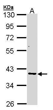 AKR7A2 Rabbit Polyclonal Antibody