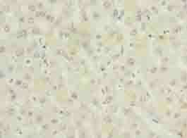 ALAS2 Antibody