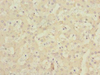 ALCAM Antibody