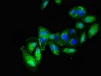 ALCAM Antibody