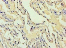 ADH7 Antibody