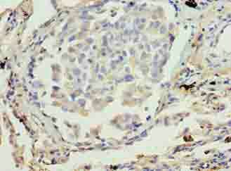 ADH7 Antibody