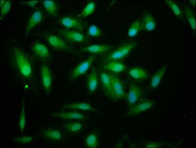 ALDH7A1 Antibody