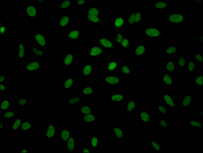 ALDOA Antibody