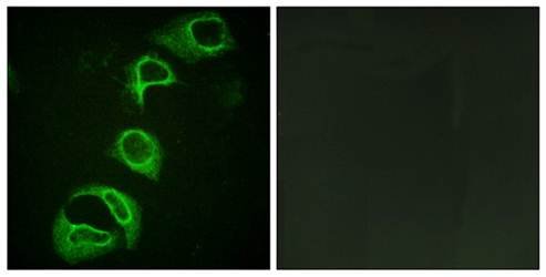 ALK (Phospho-Tyr1604) Antibody